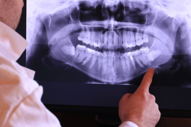 Best Emergency Dental Care for Broken or Chipped Teeth in Unionville, NC