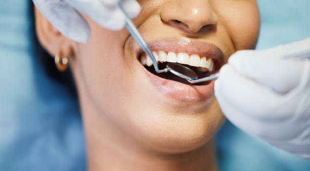 Best Emergency Gum Treatment in Unionville, NC
